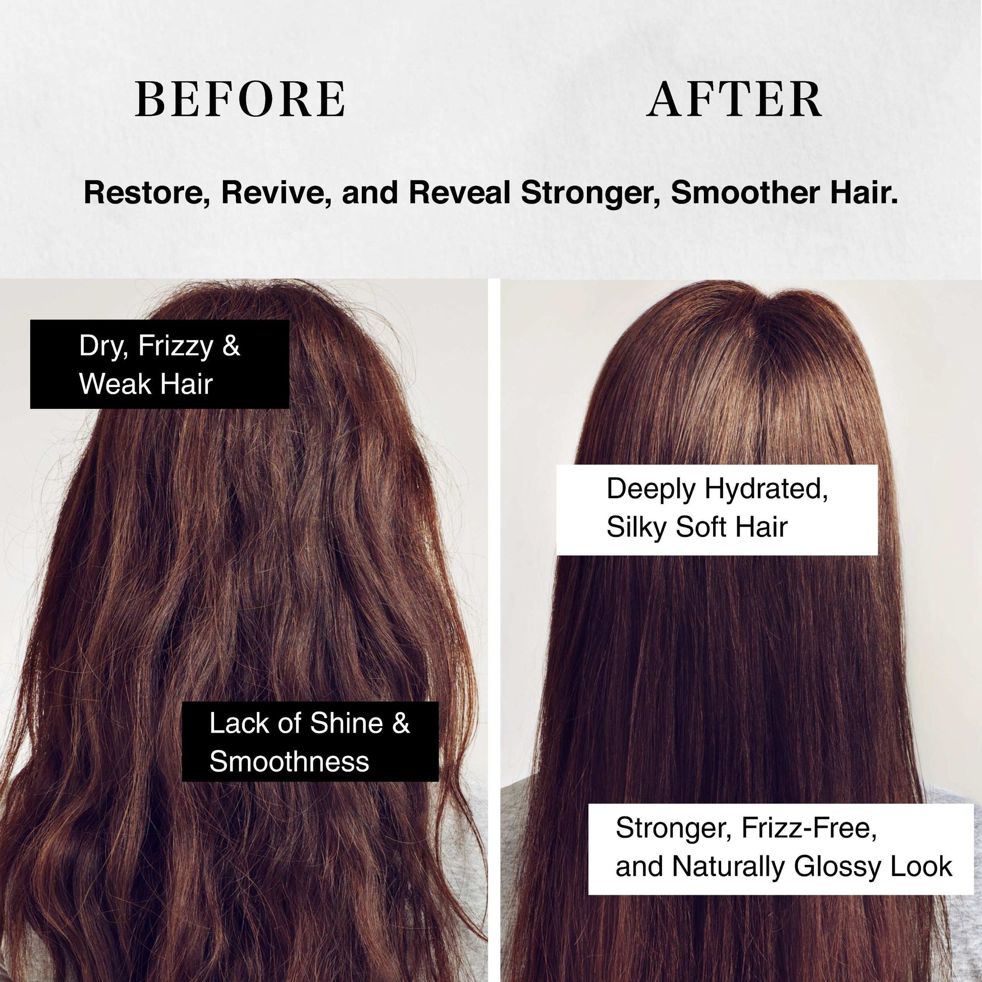 Suzyan Anti Hair Fall Shampoo + Conditioner + Hair Regrowth Serum Combo | With 4% Redensyl, 3% Anagain | Sulfate-Free | Controls Hair Fall & Boosts Regrowth | For Men & Women | 250ml + 250ml + 30ml