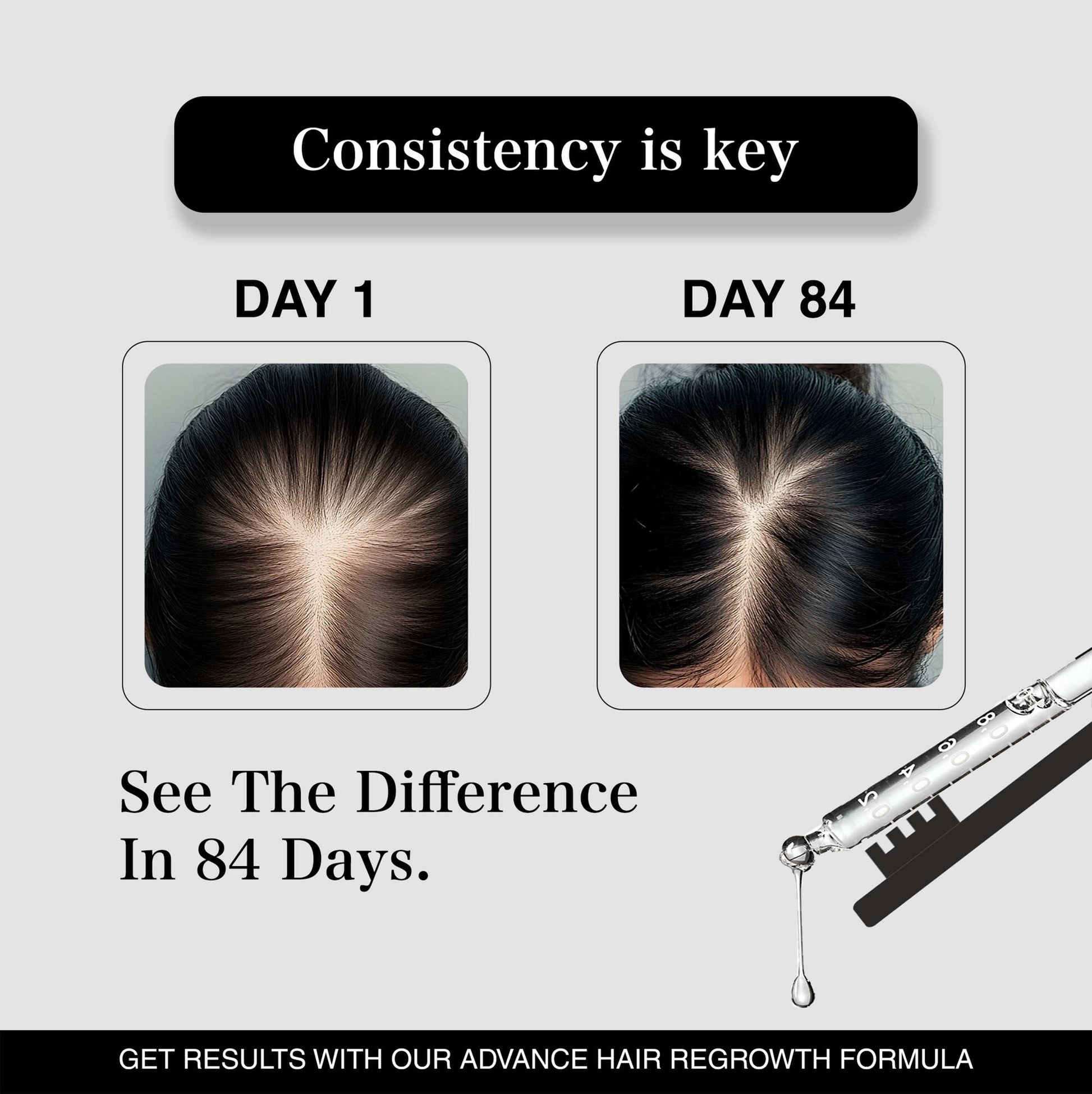 Suzyan Anti Hair Fall Shampoo + Conditioner + Hair Regrowth Serum Combo | With 4% Redensyl, 3% Anagain | Sulfate-Free | Controls Hair Fall & Boosts Regrowth | For Men & Women | 250ml + 250ml + 30ml